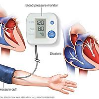 Hipertensión Arterial. ML