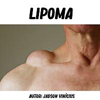 Neoplasia - Lipoma - Por Jadson Vinícius